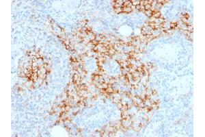 Immunohistochemistry (IHC) image for anti-CD14 (CD14) (AA 25-148) antibody (ABIN6941093)