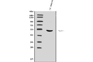Western blot analysis of Cdc25c using anti-Cdc25c antibody (ABIN7600835).