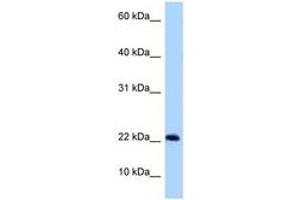 Image no. 1 for anti-Chromosome 9 Open Reading Frame 9 (C9ORF9) (AA 30-79) antibody (ABIN6748276) (C9orf9 Antikörper  (AA 30-79))
