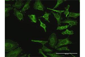 Immunofluorescence of purified MaxPab antibody to ZYX on HeLa cell. (ZYX Antikörper  (AA 1-572))