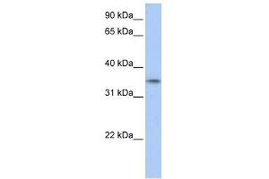 WB Suggested Anti-C17orf39 Antibody Titration: 0. (GID4 Antikörper  (C-Term))