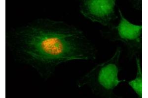 ICC/IF staining of HeLa cells using recombinant phospho-Histone H2A/H4 antibody (red). (Rekombinanter Histone H2A, H4 (H2AS1ph), (H4S1ph) Antikörper)