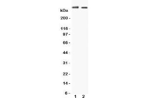 Western blot testing of Huntingtin antibody and Lane 1:  HeLa (Huntingtin Antikörper  (C-Term))