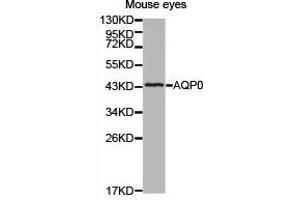 Western Blotting (WB) image for anti-Major Intrinsic Protein of Lens Fiber (MIP) antibody (ABIN1873696) (MIP Antikörper)
