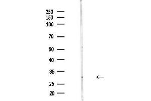 anti-Zinc Finger, C4H2 Domain Containing (ZC4H2) antibody
