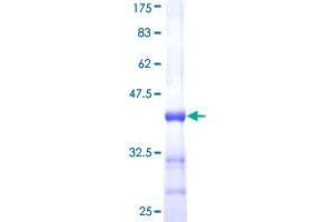 Image no. 1 for Sonic Hedgehog (SHH) (AA 181-280) protein (GST tag) (ABIN1319947)