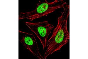 Fluorescent image of Hela cells stained with SBP Antibody (Center) C. (SAP30BP Antikörper  (AA 160-188))
