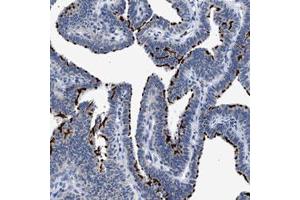 Immunohistochemical staining (Formalin-fixed paraffin-embedded sections) of human fallopian tube with RINT1 polyclonal antibody  shows strong membranous positivity in ciliated glandular cells. (RINT1 Antikörper)