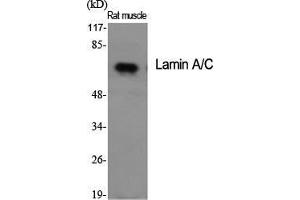Western Blot (WB) analysis of specific cells using Lamin A/C Polyclonal Antibody. (Lamin A/C Antikörper  (Ser78))