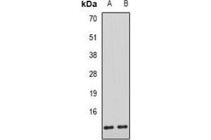 Western blot analysis of AHSP expression in mouse liver (A), rat liver (B) whole cell lysates.
