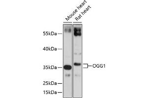 Western blot analysis of extracts of various cell lines, using OGG1 antibody (ABIN3021936, ABIN3021937, ABIN3021938 and ABIN6217976) at 1:1000 dilution. (OGG1 Antikörper  (AA 1-345))