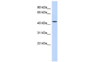 OGDH antibody used at 1 ug/ml to detect target protein. (alpha KGDHC Antikörper  (N-Term))