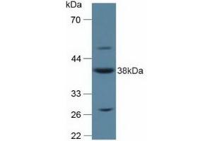 Detection of ANXA2 in Rat Placenta Tissue using Polyclonal Antibody to Annexin A2 (ANXA2) (Annexin A2 Antikörper  (AA 1-339))