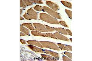 Formalin-fixed and paraffin-embedded human skeletal muscle reacted with ACTR2 Antibody , which was peroxidase-conjugated to the secondary antibody, followed by DAB staining. (ACTR2 Antikörper  (AA 191-219))