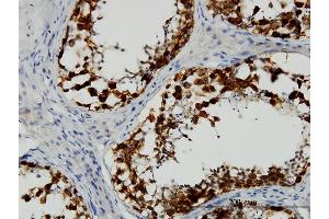 Immunoperoxidase of monoclonal antibody to DAZ1 on formalin-fixed paraffin-embedded human testis. (DAZ1 Antikörper  (AA 21-120))