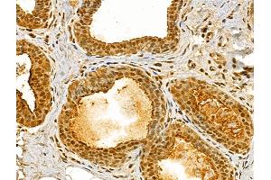 ABIN6262635 and ABIN6273051 at 1/100 staining Human normal tissues adjacent to breast cancer by IHC-P. (Importin 4 Antikörper  (Internal Region))