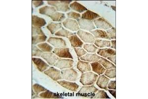 SAR1B antibody (Center) (ABIN654355 and ABIN2844120) immunohistochemistry analysis in formalin fixed and paraffin embedded human skeletal muscle followed by peroxidase conjugation of the secondary antibody and DAB staining. (SAR1B Antikörper  (AA 89-116))