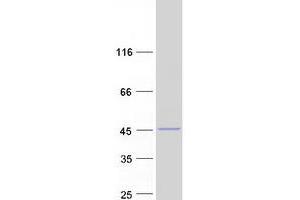 Validation with Western Blot (RDH10 Protein (Myc-DYKDDDDK Tag))