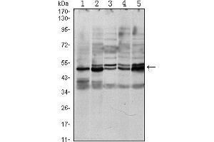 Western blot analysis using SMAD3 mouse mAb against A549 (1), Hela (2), Jurkat (3), PC-2 (4) and NIH/3T3 (5) cell lysate.