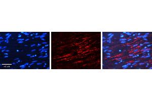 Immunohistochemistry (IHC) image for anti-Insulin Receptor (INSR) (Middle Region) antibody (ABIN2776773)