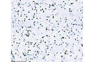 IHC analysis of ADAR1/ADAR using anti-ADAR1/ADAR antibody (ABIN7598956).