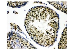 IHC analysis of KDM5B using anti-KDM5B antibody (ABIN4886648). (KDM5B Antikörper  (Middle Region))