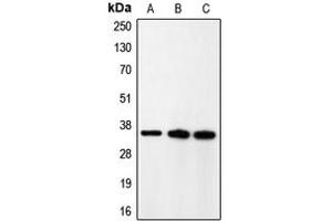 Western blot analysis of p35 expression in rat brain (A), HeLa (B), A431 (C) whole cell lysates. (CDK5R1 Antikörper  (N-Term))