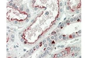 IHC staining of FFPE human kidney with PRAK antibody at 5ug/ml. (MAPKAP Kinase 5 Antikörper)