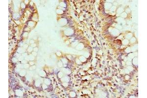 Immunohistochemistry of paraffin-embedded human small intestine tissue using ABIN7154289 at dilution of 1:100 (GMP Synthase Antikörper  (AA 394-693))