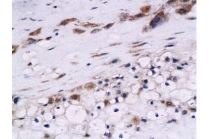 Formalin-fixed and paraffin embedded human placenta labeled with Anti-Cystatin B Polyclonal Antibody, Unconjugated  at 1:200 followed by conjugation to the secondary antibody and DAB staining (CSTB Antikörper  (AA 51-98))