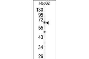 Western blot analysis of ARSB antibody (C-term) (ABIN391670 and ABIN2841581) in HepG2 cell line lysates (35 μg/lane). (Arylsulfatase B Antikörper  (C-Term))