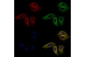 ABIN6262856 and ABIN6277036 staining Hela cells by IF/ICC.