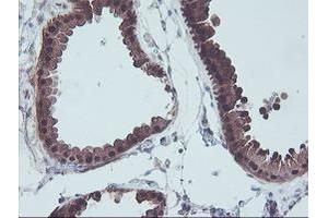 Immunohistochemical staining of paraffin-embedded Human breast tissue using anti-ACY1 mouse monoclonal antibody. (Aminoacylase 1 Antikörper)