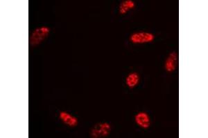 Immunofluorescent analysis of Histone Deacetylase 3 staining in HeLa cells. (HDAC3 Antikörper  (C-Term))