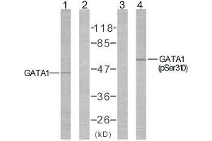 Western blot analysis of extracts from COS7 cells using GATA1 (Ab-310) antibody ( E021042, Line1 and 2) and GATA1 (phospho-Ser310) antibody (E011042, Line3 and 4). (GATA1 Antikörper)