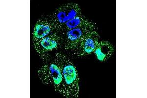 Confocal immunofluorescent analysis of TI Antibody (C-term) (ABIN655149 and ABIN2844770) with  cell followed by Alexa Fluor 488-conjugated goat anti-rabbit lgG (green). (TIMP1 Antikörper  (C-Term))