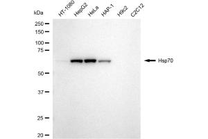 Western blotting analysis using Hsp70 antibody (ABIN7798852).