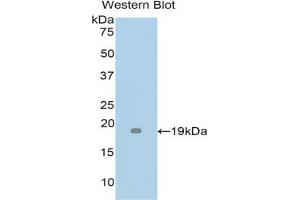 Detection of Recombinant TNFb, Mouse using Polyclonal Antibody to Tumor Necrosis Factor Beta (TNFb) (LTA Antikörper  (AA 49-202))