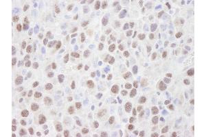 Immunohistochemistry (IHC) image for anti-Histone Deacetylase 2 (HDAC2) (C-Term) antibody (ABIN7448973)