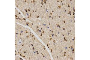 Immunohistochemistry (IHC) image for anti-Histone H4 (3meLys20) antibody (ABIN6219533) (Histone H4 Antikörper  (3meLys20))