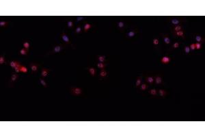 ABIN6266612 staining A-431 cells by IF/ICC. (p63 Antikörper  (C-Term))