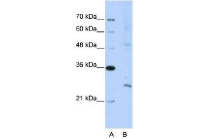 EXOSC4 antibody used at 5 ug/ml to detect target protein. (EXOSC4 Antikörper  (N-Term))