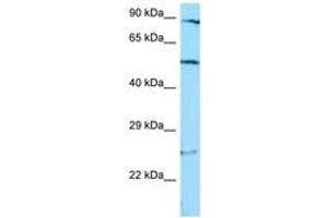 Image no. 1 for anti-STAM Binding Protein (STAMBP) (C-Term) antibody (ABIN6748275)