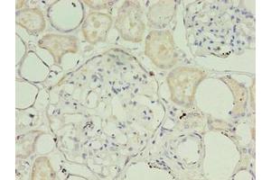 Immunohistochemistry of paraffin-embedded human kidney tissue using ABIN7159886 at dilution of 1:100 (TIMM1B (AA 1-103) Antikörper)