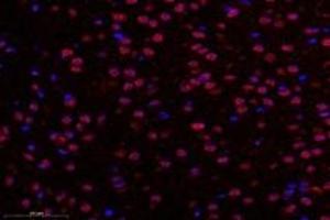 Immunofluorescent analysis of paraformaldehyde-fixed rat substantia nigra using TBXT (ABIN7075815) at dilution of 1: 600 (T-Box 19 Antikörper)