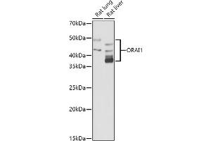 Western blot analysis of extracts of various cell lines, using (ABIN6130598, ABIN6145053, ABIN6145055 and ABIN6223281) at 1:1000 dilution. (ORAI1 Antikörper  (AA 202-301))