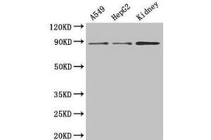 Western Blot Positive WB detected in: A549 whole cell lysate, HepG2 whole cell lysate, Mouse kidney tissue All lanes: ASPH antibody at 3 μg/mL Secondary Goat polyclonal to rabbit IgG at 1/50000 dilution Predicted band size: 86, 35, 26, 24, 34, 84, 30, 22, 29, 33 kDa Observed band size: 86 kDa (Aspartate beta Hydroxylase Antikörper  (AA 75-270))