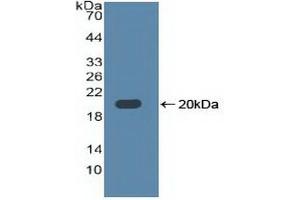 Detection of Recombinant TLR3, Human using Polyclonal Antibody to Toll Like Receptor 3 (TLR3) (TLR3 Antikörper  (AA 404-532))