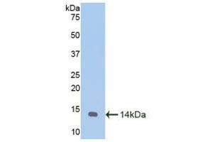 Western blot analysis of recombinant Goat MTNR1A. (Melatonin Receptor 1A Antikörper  (AA 312-366))