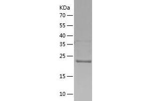 Western Blotting (WB) image for HIV-1 Tat Interactive Protein 2, 30kDa (HTATIP2) (AA 1-242) protein (His tag) (ABIN7123349) (HIV-1 Tat Interactive Protein 2, 30kDa (HTATIP2) (AA 1-242) protein (His tag))